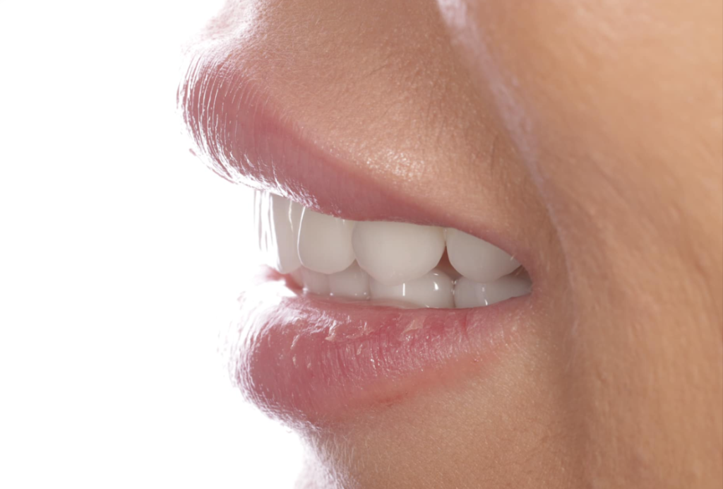 Циркониевые коронки